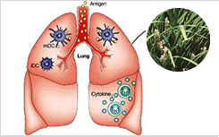 Sun Ten Ophiopogon Combination (Mai Men Dong Tang) Effectively Improve Symptoms of Allergic Asthma