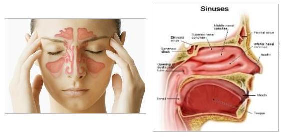 Can Sinus Pressure Cause Lower Jaw Pain